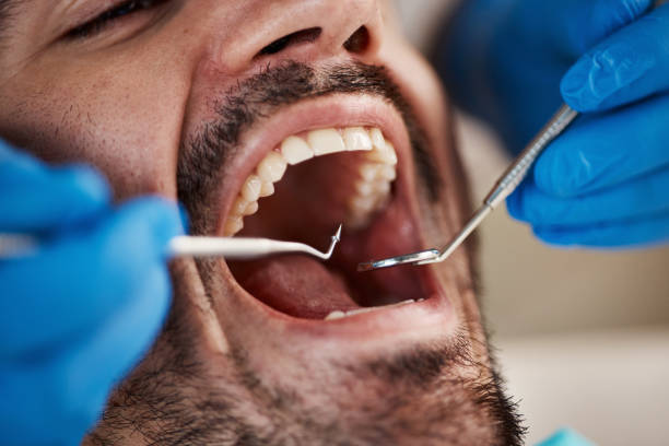 Oral Surgery in Prunedale, CA