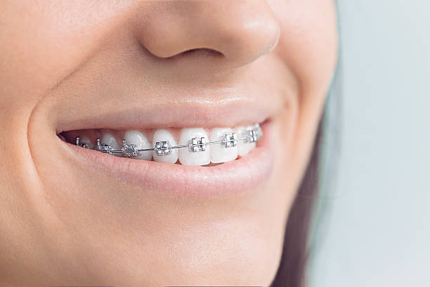 Best Root Canal Treatment  in Prunedale, CA